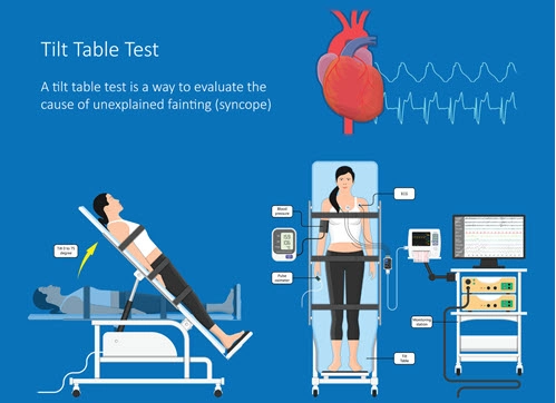 Tilt Table Testing: A Deep Dive into the Diagnostic Process - Longmore  Clinic